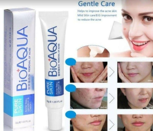 BIOAQUA Pure Skin Acne Removal Anti-Wrinkle Treatment Cream