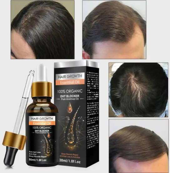 Peimei Original Hair Growth Oil - ValueBox