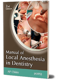Manual Of Local Anesthesia In Dentistry 2nd Ed By AP Chitre - ValueBox