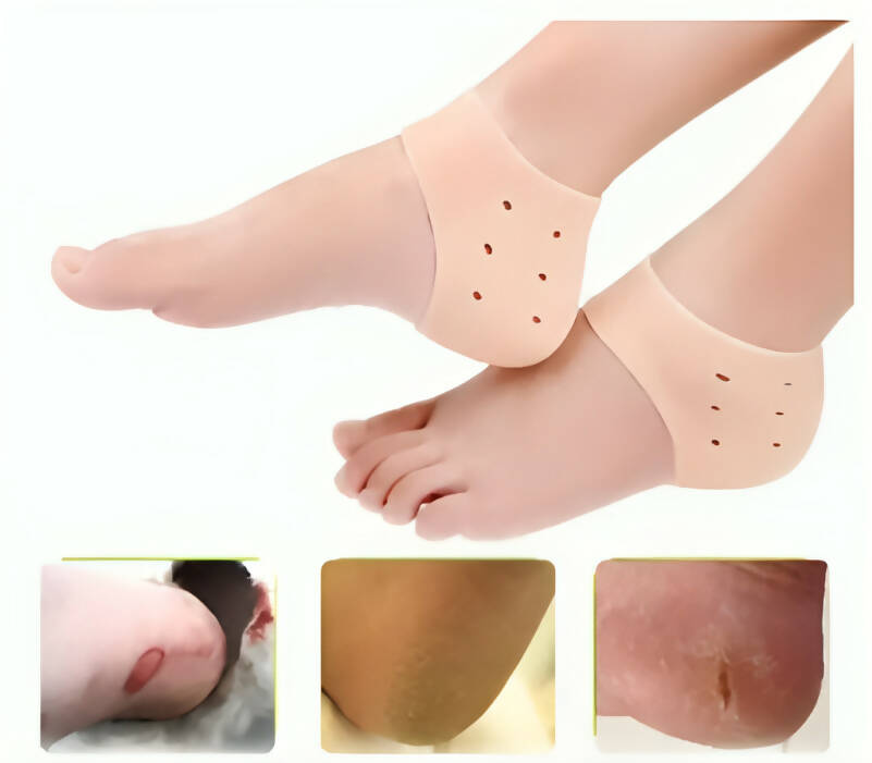 1 Pair (2PCS) Silicone Gel Heel Crack Protector Anti Crack Moisturizing Foot Pain Care Leg Pain Relief Heel Socks Tumit Sakit Non-Slip Silicone Sock (Human Skin Color)