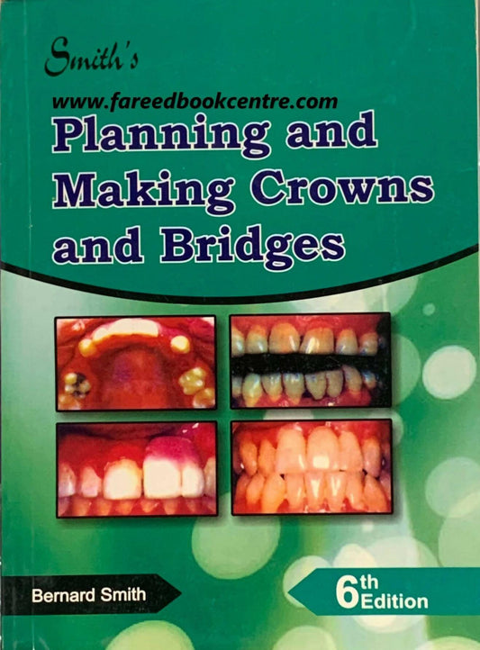 Planning And Making Crowns And Bridges 6th Edition - ValueBox