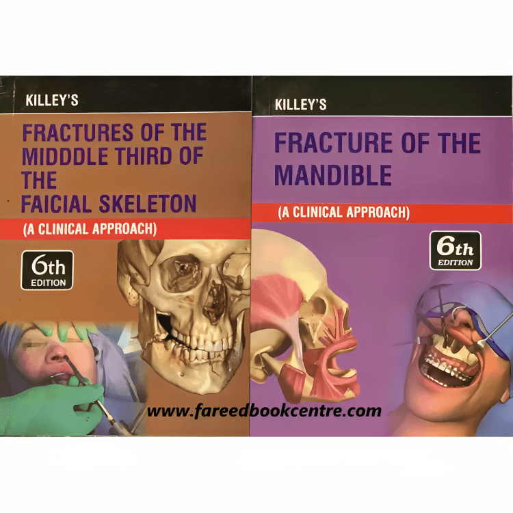 Killey”s Fractures of the Midddle Third of the Faicial Skeleton and Fracture of the Mandible 6th Edition Both Vol - ValueBox